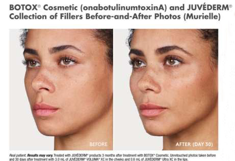 American Academy Of Facial Esthetics