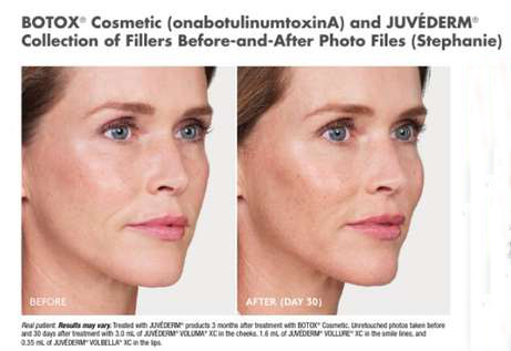 American Academy Of Facial Esthetics